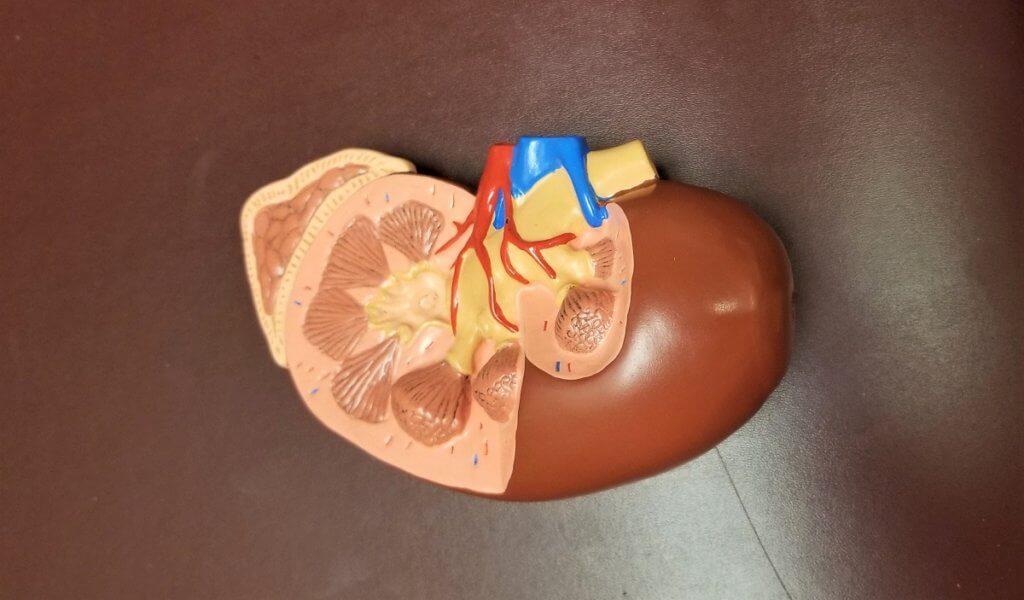 plastic diagram of a kidney
