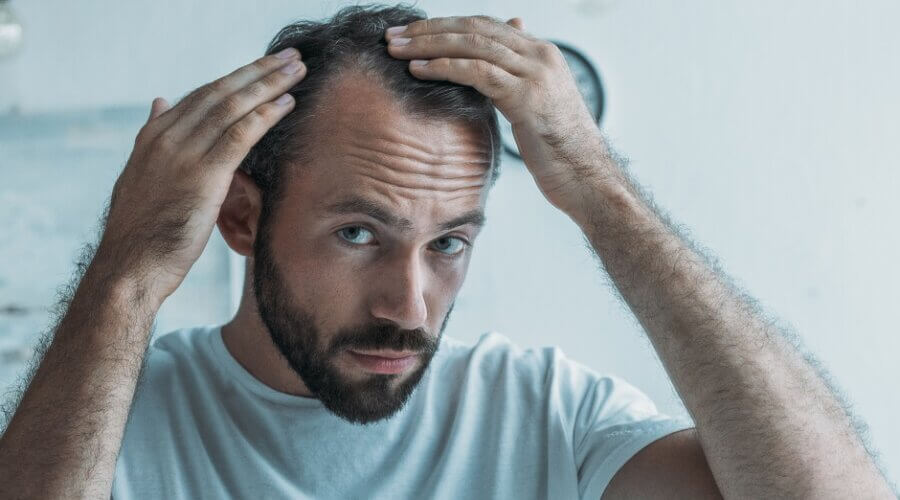 mid adult man with alopecia looking at mirror, hair loss concept